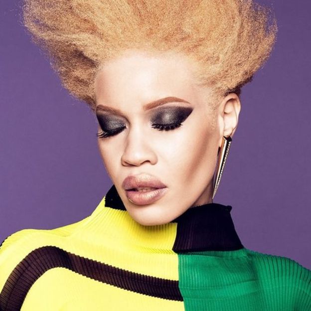 Diandra Forrest, premier mannequin albinos égérie d’une grande marque de beauté