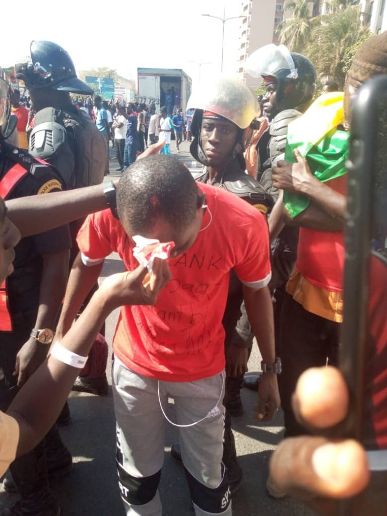 Marche de Noo Lànk : Une foule, des jets de pierre, des blessés