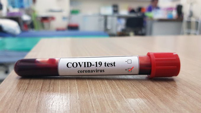 Covid-19 : Matam enregistre son premier cas positif au coronavirus ce lundi