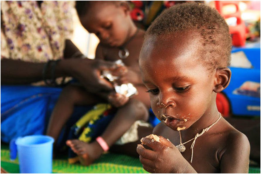 Sénégal : La Chine appuie l’Unicef dans la prise en charge des enfants souffrant de malnutrition aiguë