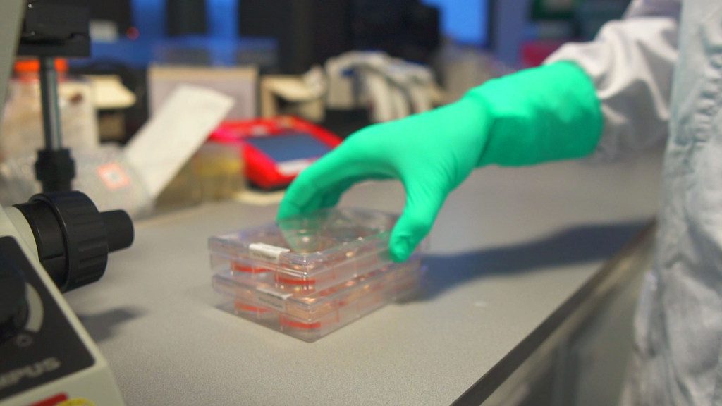 Covid-19 : Un deuxième variant britannique porteur de huit mutations découvert au Sénégal